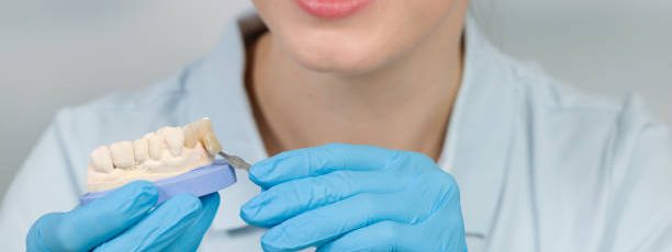 how long does a dental bridge last lifespan care tips