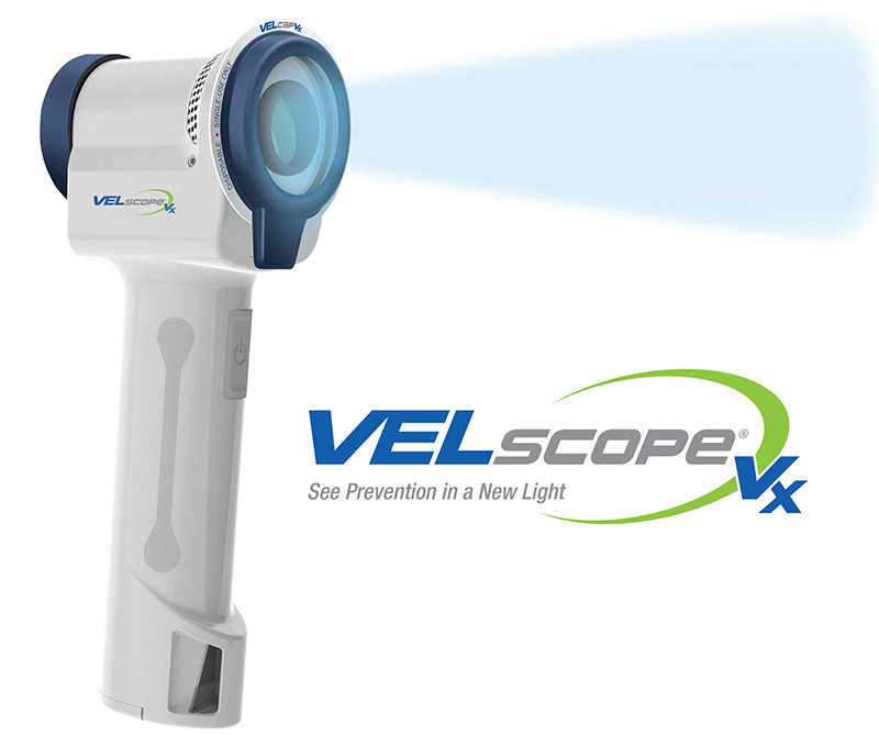 velscope oral cancer screening machine