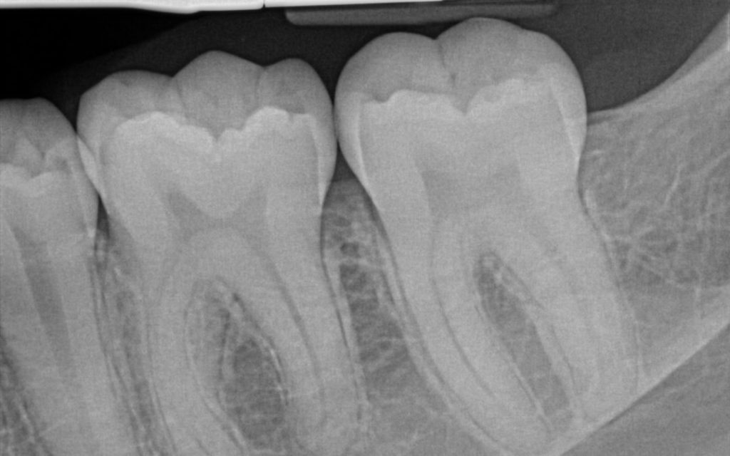 x-rays and your dental health
