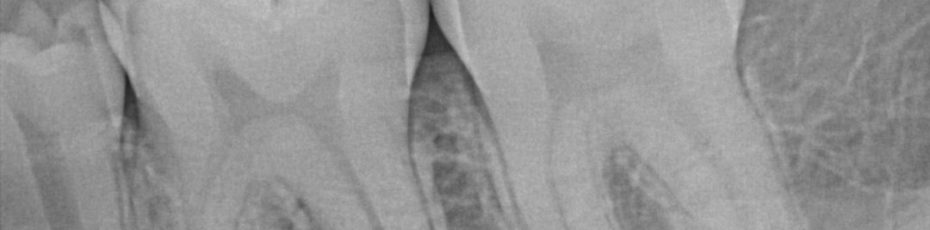 X-Rays & Your Dental Health