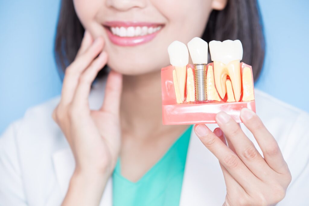 how many years do the dental implants last