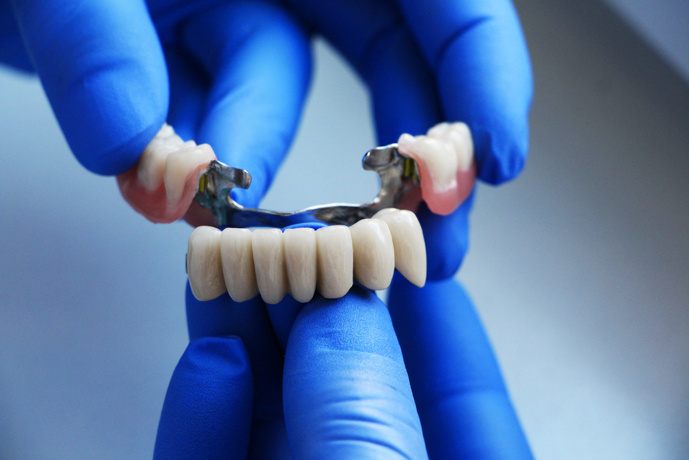 how to care for your dental bridge