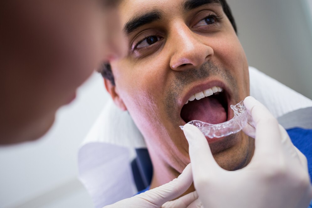 How Long Will Your Mouth Guard Last? | Mouth Guard Care Tips in Mokena