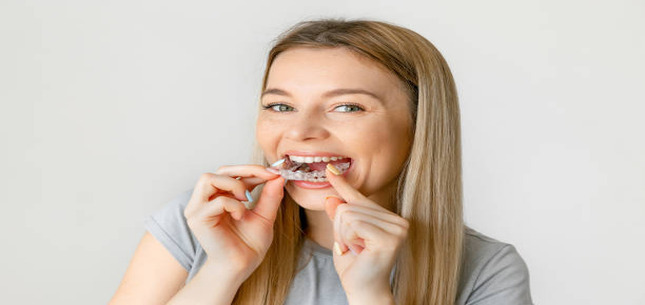 clear aligners