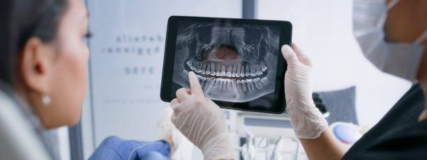 dental-x-ray