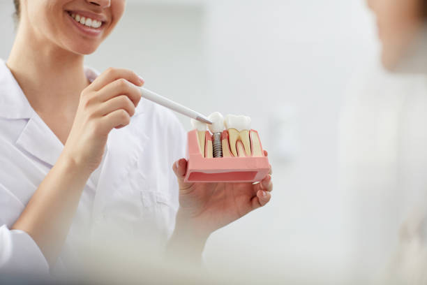 smile makeovers with dental implants