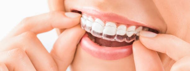 how do mouthguards protect your teeth